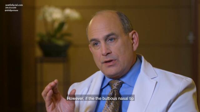 Rhinoplasty Surgery - Reduction/Removing a Bulbous Nasal Tip  - Nose Job
