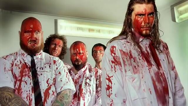 General Surgery - Ambulance chaser