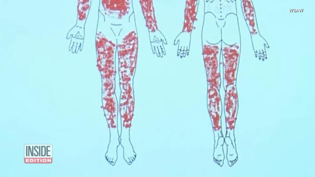 1984 Cold Case Death of Janet Raasch Was Accidental: Cops