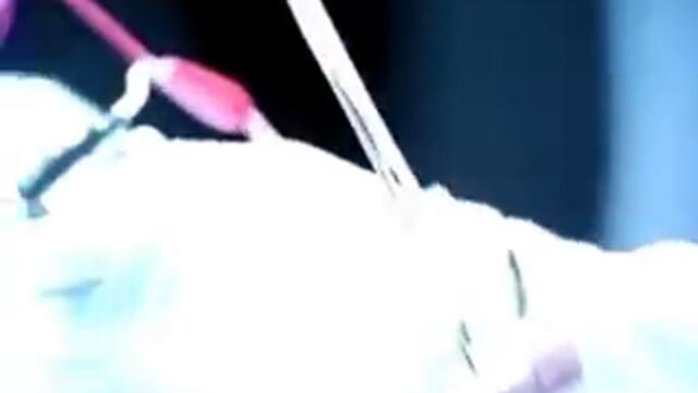 3dfx - Revolutionize Medicine - TV commercial