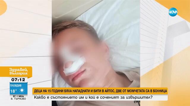 Счупени нос и челюст: Жесток побой над тийнейджъри в Айтос, двама са в болница
