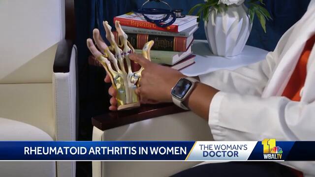 Woman's Doctor: Here's how to treat rheumatoid arthritis