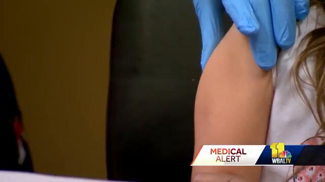 Doctors concerned about measles, even in Maryland