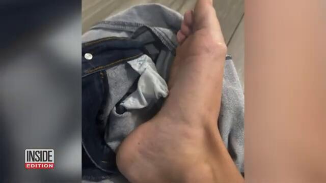 Woman Gets Key Stuck Inside Her Foot After Stepping on Jeans