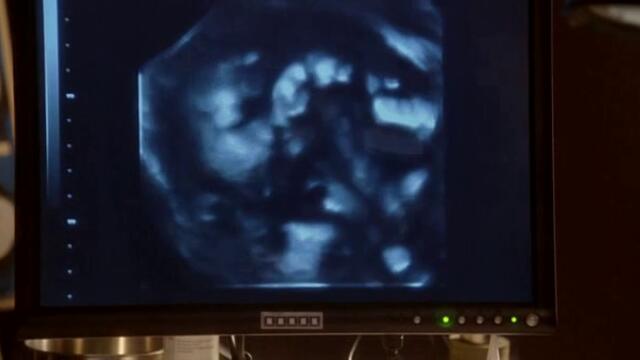 Smallville / Смолвил: Супермен в началото Сезон 6 Епизод 16 Бг Субтитри